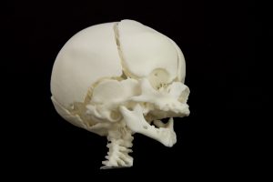 3D Printed Anatomical models for surgery preparation